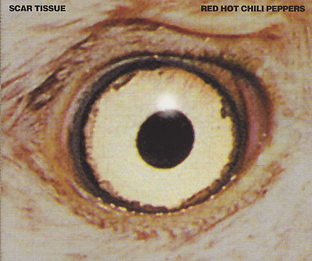 Scar Tissue